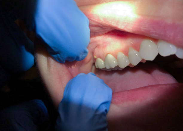 Best Tooth Infection Emergency Dentist  in South Monroe, MI