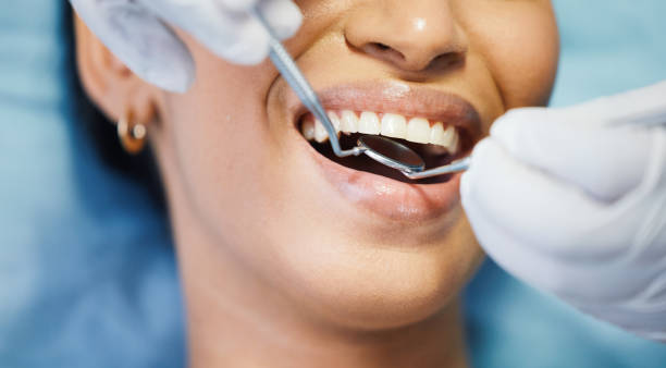 Best Dentist for Tooth Abscess  in South Monroe, MI